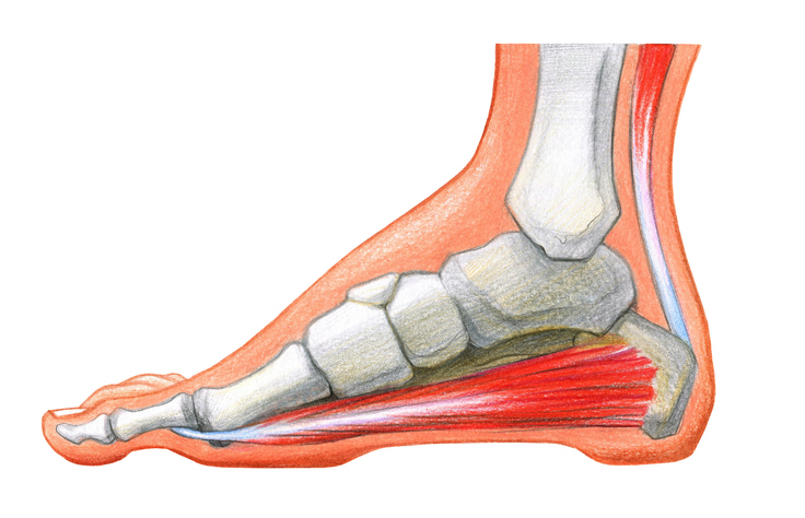 足底筋膜炎とは チェック方法 原因 治し方 改善トレーニングを紹介 Tential テンシャル 公式オンラインストア