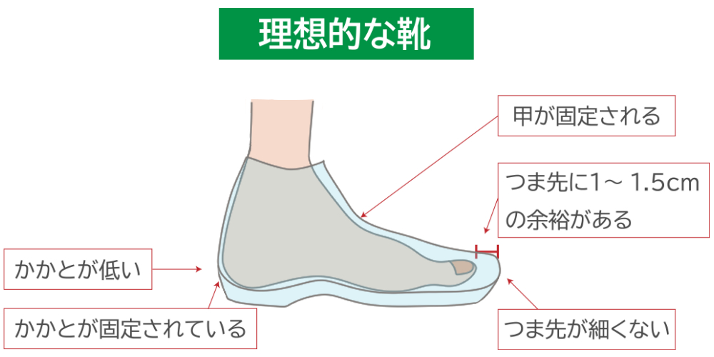 外反母趾の正しい予防方法 靴の選び方 正しい歩き方 マッサージの仕方を紹介 Tential テンシャル 公式オンラインストア