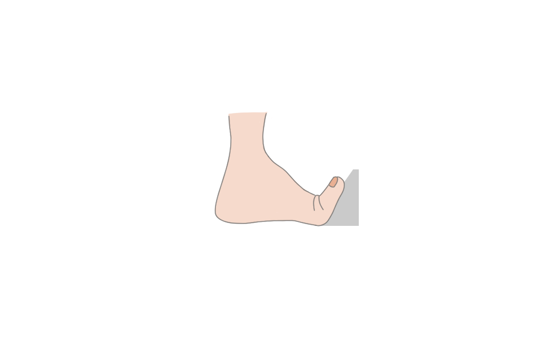 外反母趾のストレッチ方法について解説 予防と痛みの緩和に効果的 Tential テンシャル 公式オンラインストア