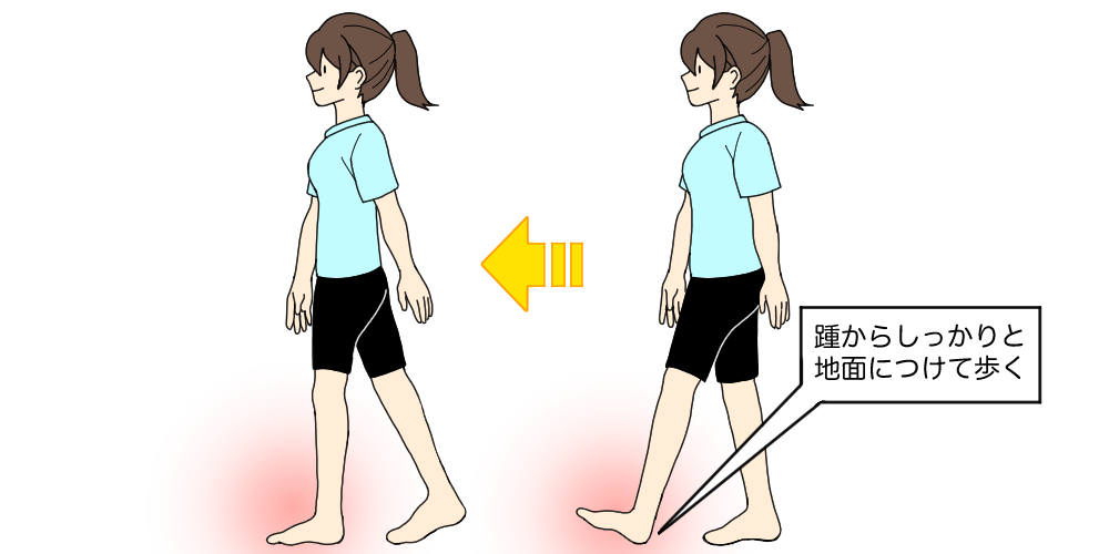 扁平足の原因になる歩き方の特徴と扁平足になりにくい歩き方を紹介 Tential テンシャル 公式オンラインストア