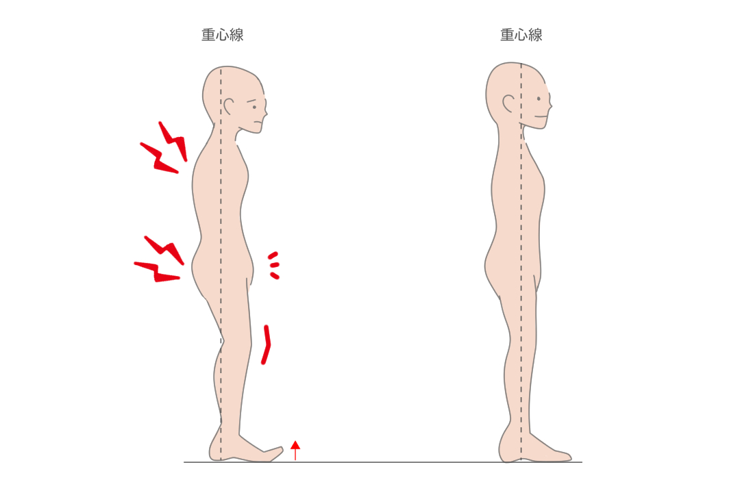 浮き指の原因 浮き指が悪化するとどうなるのか 改善方法は Tential テンシャル 公式オンラインストア