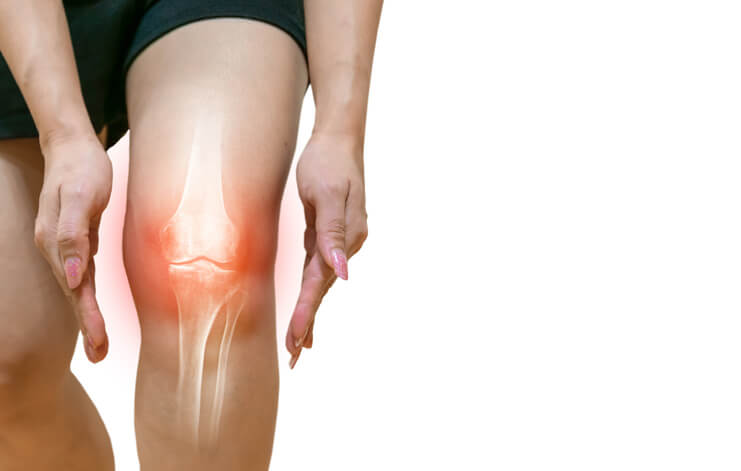 変形性膝関節症ってどんな症状 痛みや音 原因について解説 Tential テンシャル 公式オンラインストア