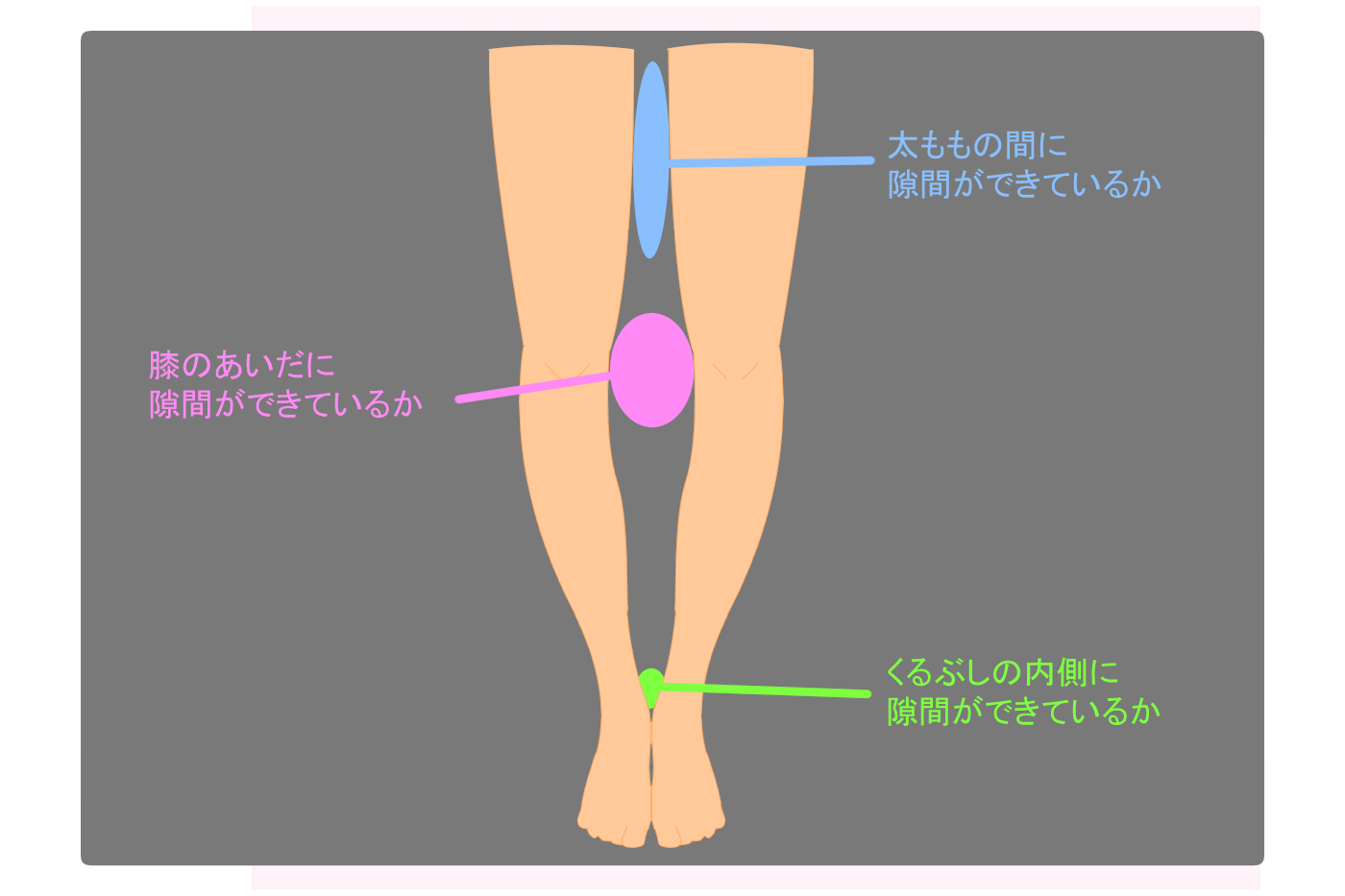 O脚とは 原因や改善 矯正方法を紹介 Tential テンシャル 公式オンラインストア