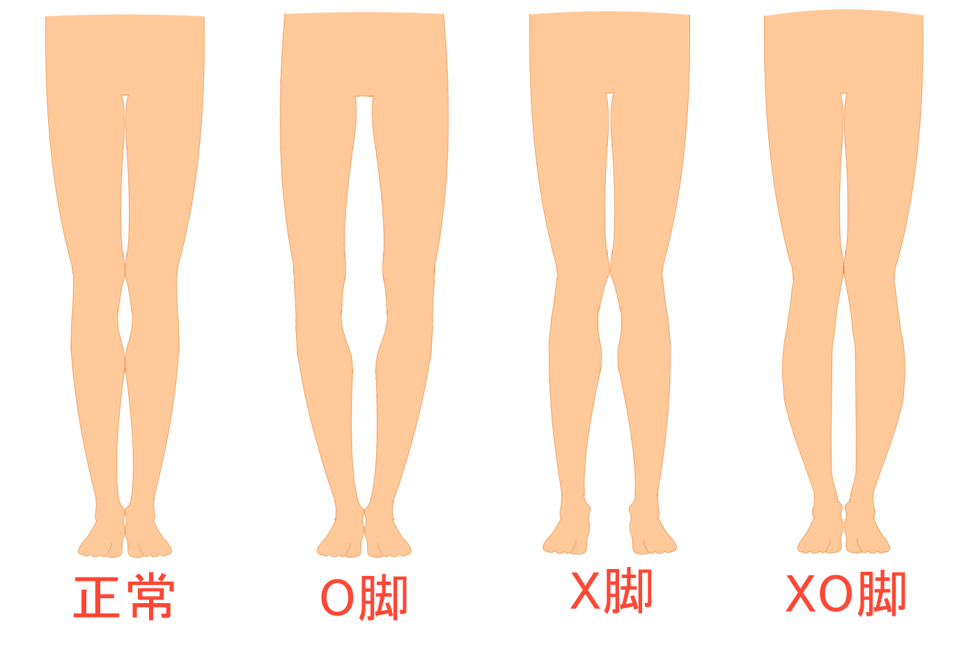 O脚の原因4選を解説！O脚矯正に役立つ歩き方やエクササイズも紹介