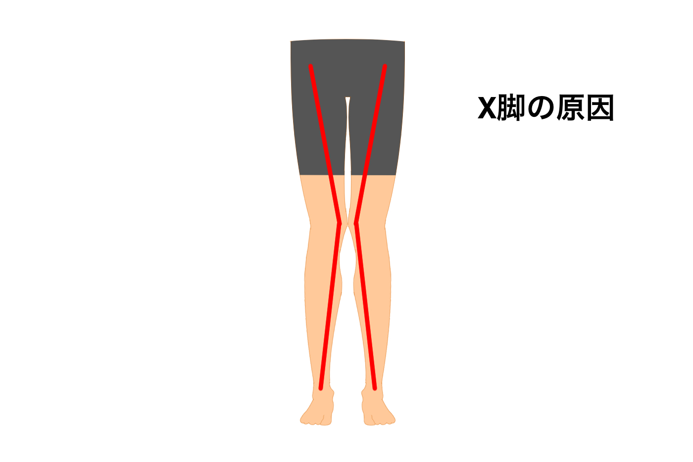 X脚はなぜ起きてしまうの X脚の原因と改善法を徹底解説 Tential テンシャル 公式オンラインストア