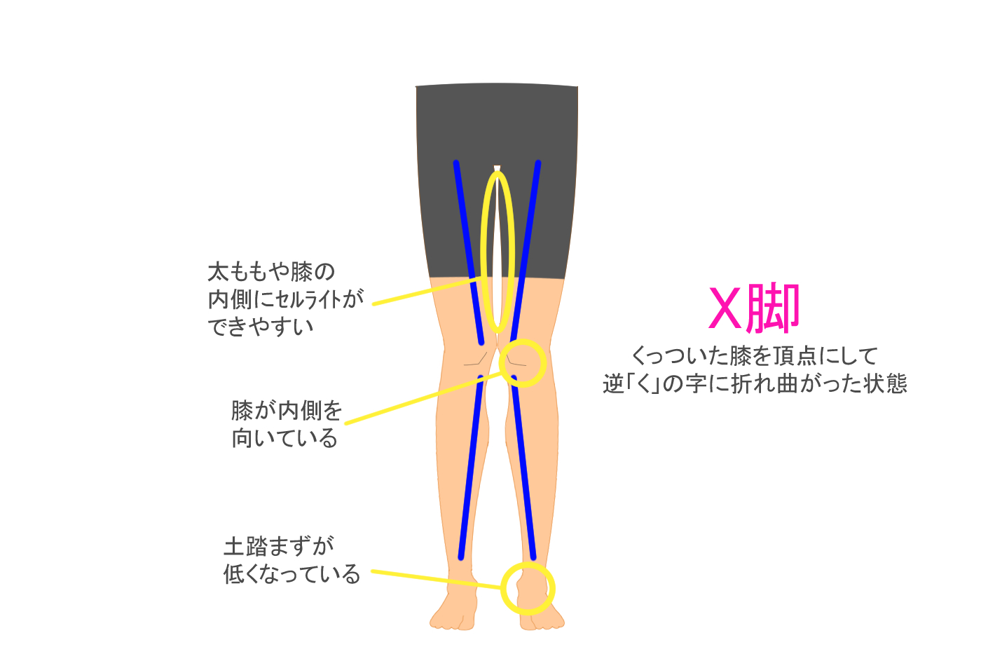 X脚にストレッチって良いの ストレッチの効果ややり方を徹底解説 Tential テンシャル 公式オンラインストア