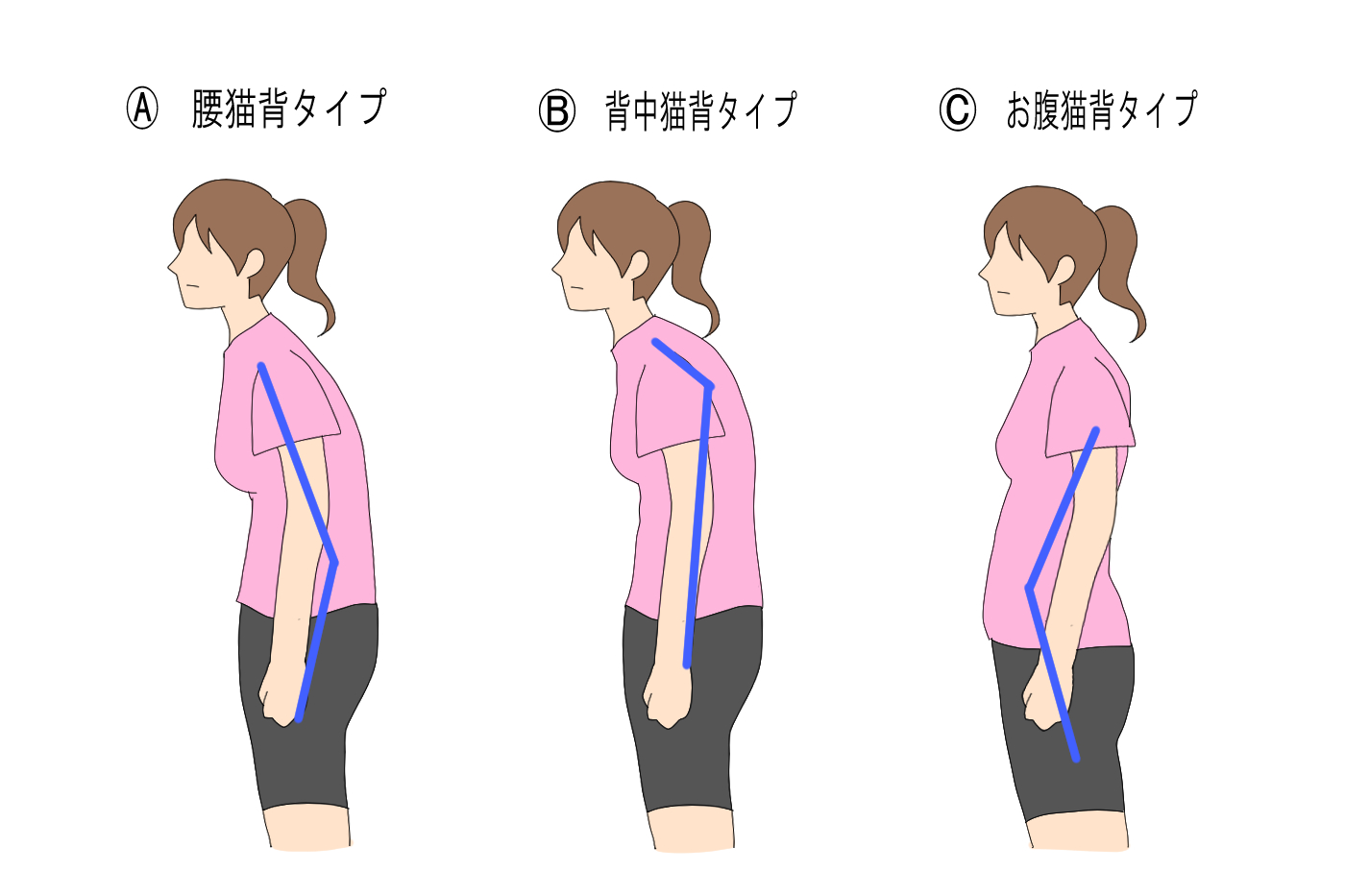 猫背って何 チェック方法を紹介 Tential テンシャル 公式オンラインストア